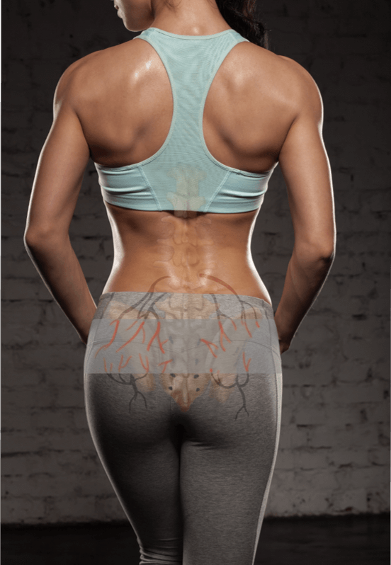 Blog Image When an SIJ Belt Causes Pain lowres