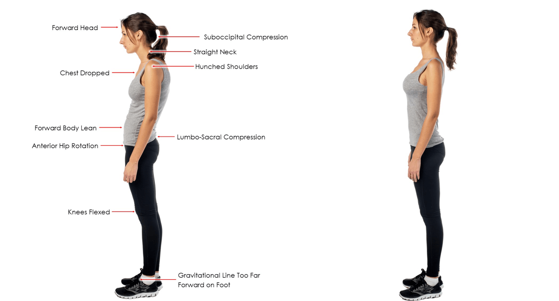 Bad vs Good Posture 1 e1758542895529